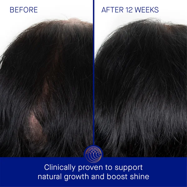 Augustinus Bader The Scalp Treatment 30ml