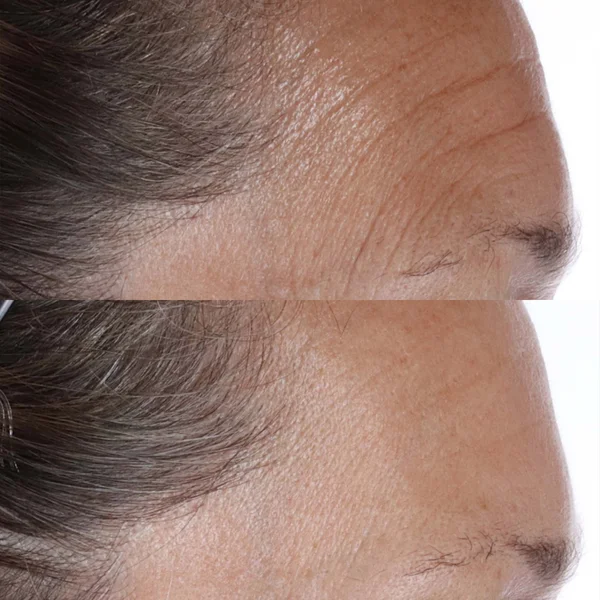 DISCO Perricone MD FG EFx Chia Oil 1oz FG