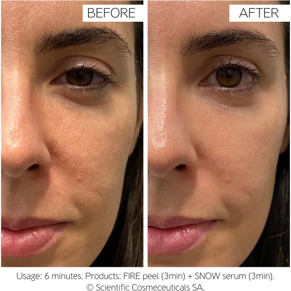 Dr. LEVY Switzerland Fire & Snow