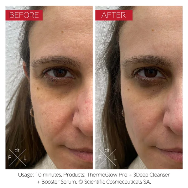 Dr. LEVY Switzerland The ThermoGlow Pro Device