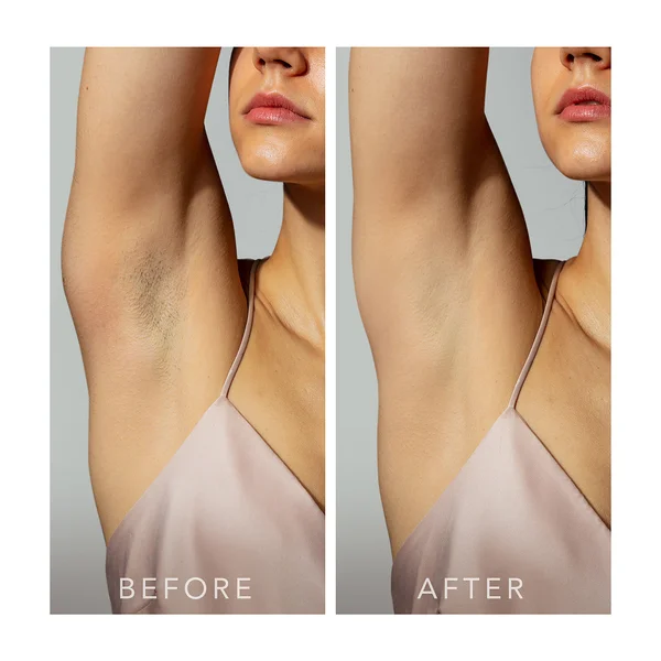 FOREO PEACH 2 Device - Peach