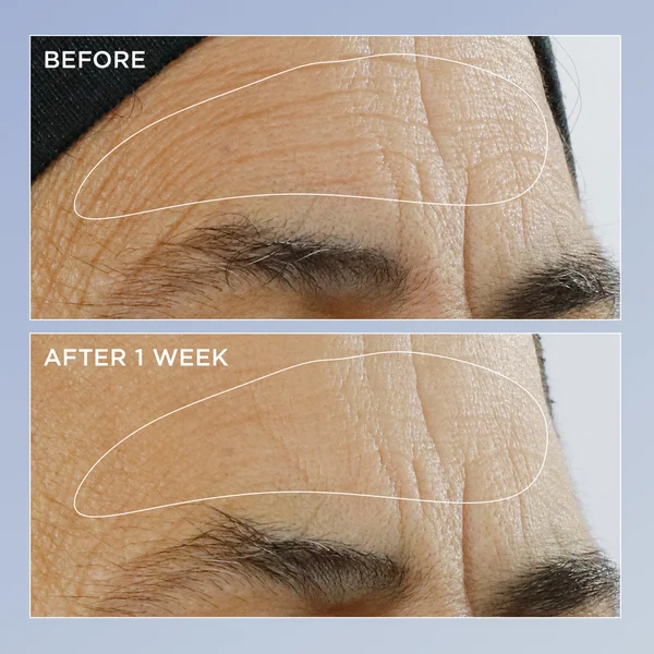 High Potency Triple Retinol Renewal Serum