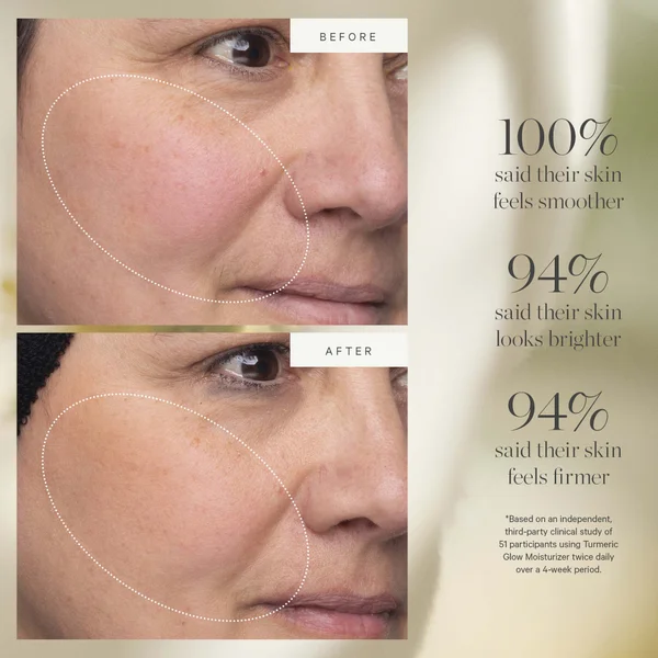 Kora Organics Turmeric Glow Moisturizer (15ml)
