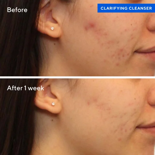 Murad Clarifying Cleanser 200ml