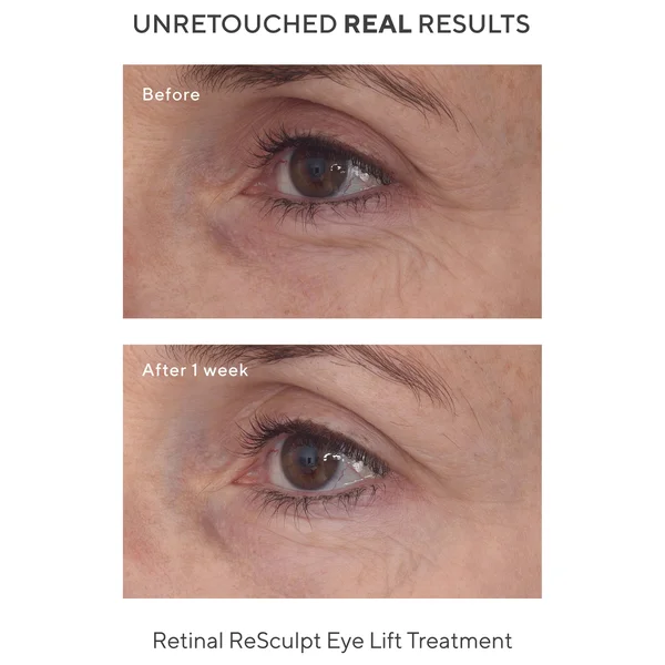 Murad Retinal ReSculpt Eye Treatment 15ml