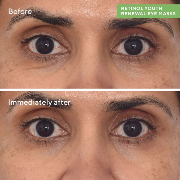 Murad Retinol Youth Renewal Eye Masks (5 Pack)