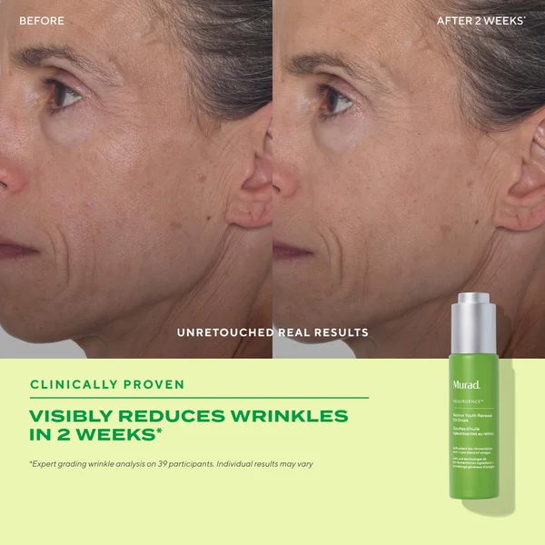 Murad Retinol Youth Renewal Oil Drops 30ml