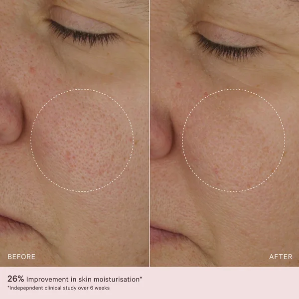 MZ SKIN Light Moisturiser 50ml