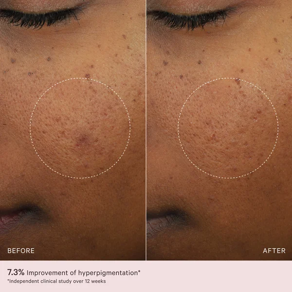 MZ Skin Micro-Peeling Glow Essence 100ml