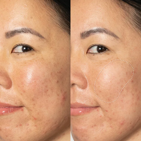 OLE HENRIKSEN Glow 2 OH Dark Spot Toner 190ml