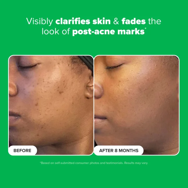 Paula's Choice 10% Azelaic Acid Booster 30ml