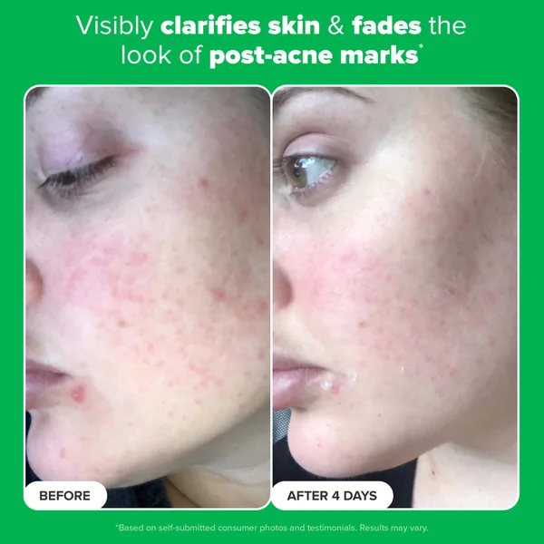 Paula's Choice 10% Azelaic Acid Booster 30ml