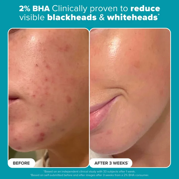 Paula's Choice Multi-Level Exfoliation Kit