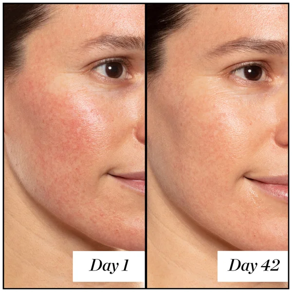 Sunday Riley A+ High-Dose Retinoid Serum 50ml