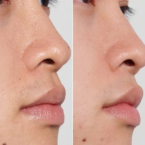 The INKEY List PHA Toner 100ml