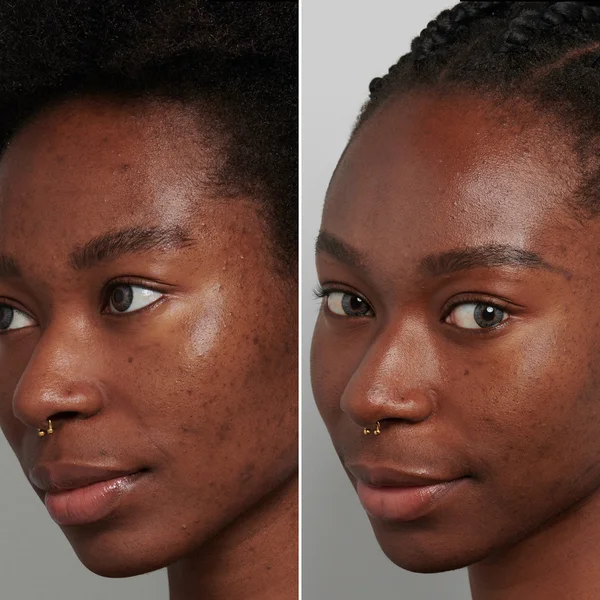 The INKEY List Tranexamic Acid Serum 30ml