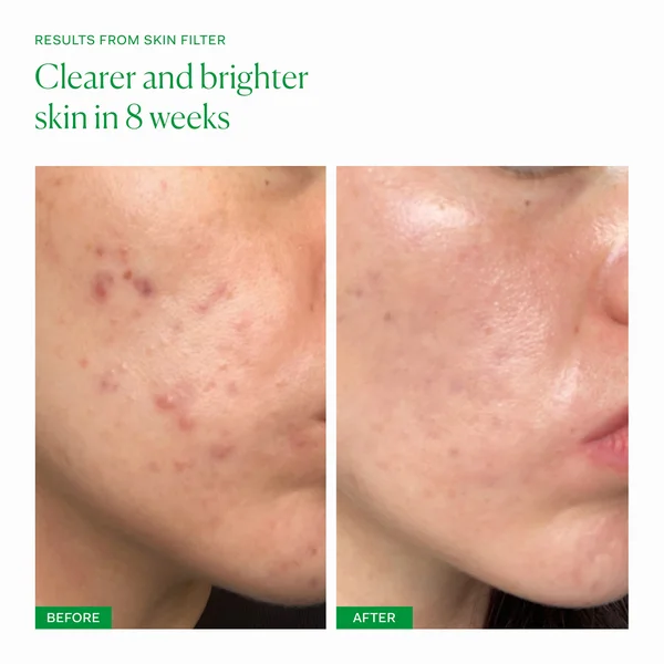 The Nue Co. Skin Filter (30 Capsules)