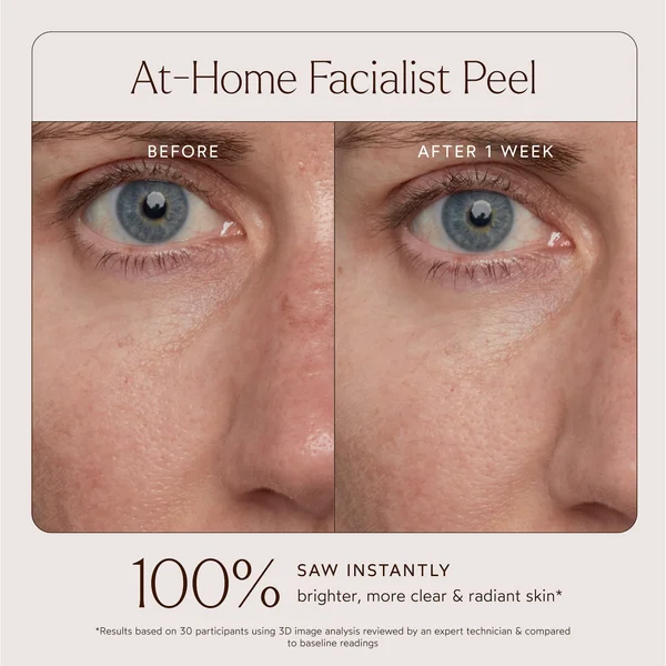 True Botanicals At-Home Facialist Peel 30ml