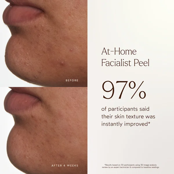 True Botanicals At-Home Facialist Peel 30ml