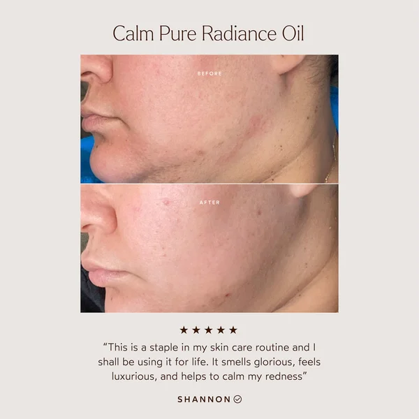 True Botanicals Calm Pure Radiance Oil 30ml