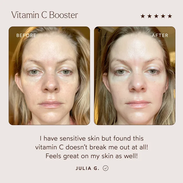 True Botanicals Vitamin C Booster 14g