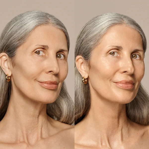 VIEVE Skin Nova - 10ml