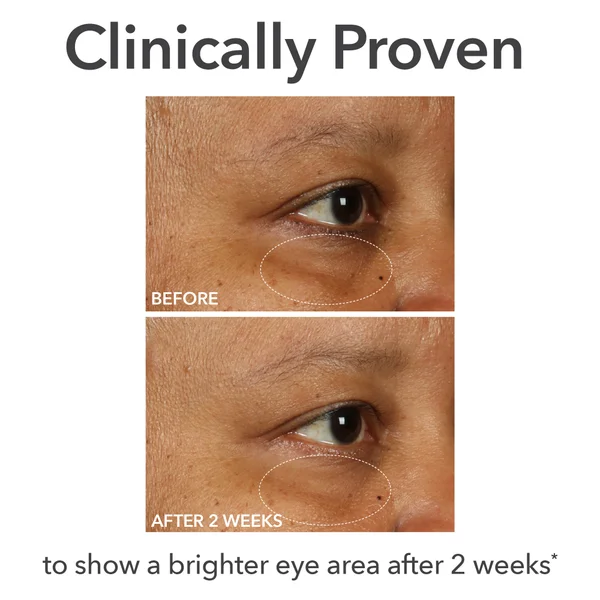 Dr Dennis Gross Skincare DermInfusions Fill + Repair Eye Cream 15ml