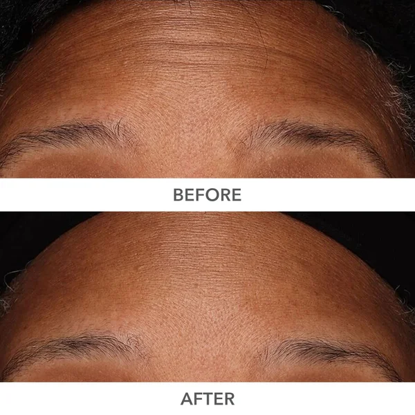 Dr Dennis Gross Skincare DermInfusions Plump Fill And Repair Kit