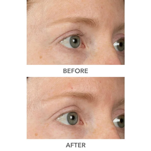 Dr Dennis Gross Skincare DermInfusions Plump Fill And Repair Kit