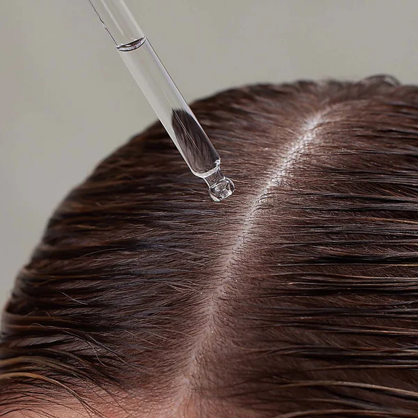 Innersense Hair Renew Daily Active Scalp Treatment 30ml