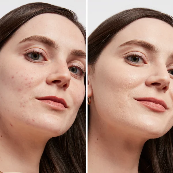 IT Cosmetics Bye Bye Dark Spot Concealer 33g (Various Shades)