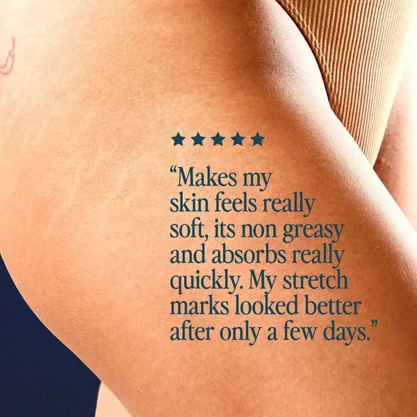 Luna Daily The Skin Support Oil For Stretch Marks And Hyperpigmentation 100ml