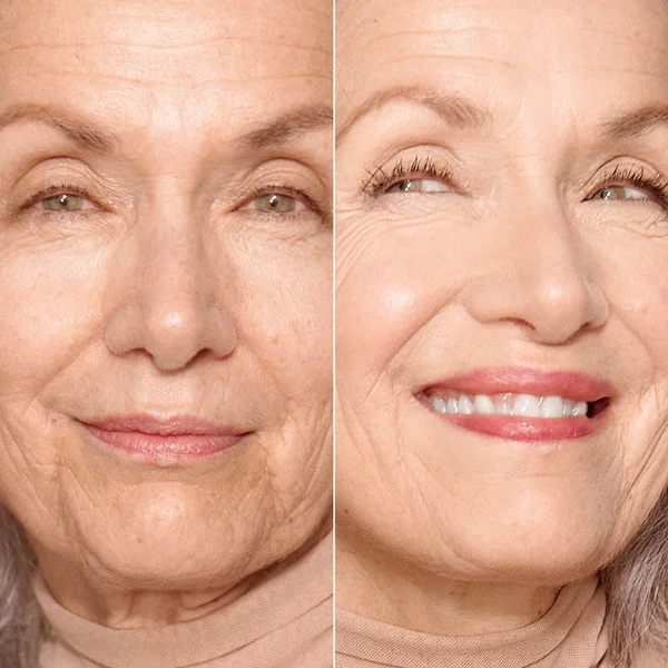 NUDESTIX Nudefix Cream Concealer 10ml (Various Shades)