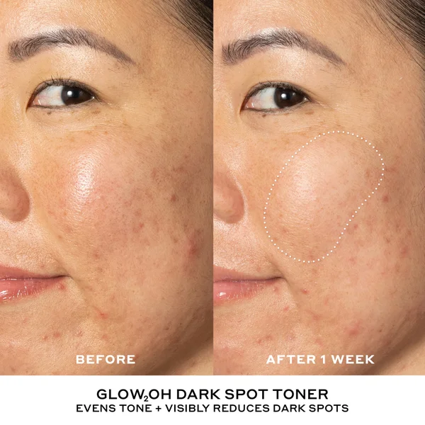 OLE HENRIKSEN Best And Brightest Mini Skincare Starter Set