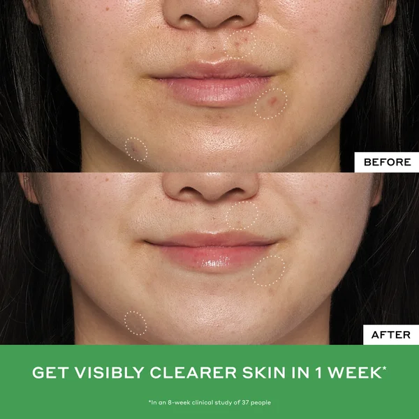 Ole Henriksen Detox Drops 2% Salicylic Acid Toner 120ml