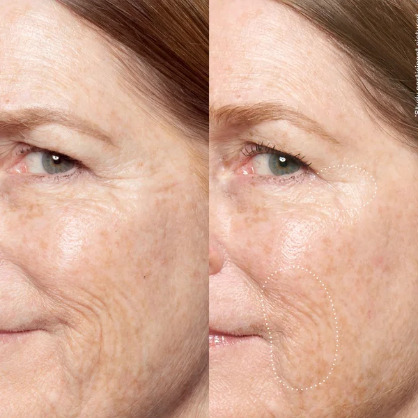 OLE HENRIKSEN Double Rewind 0.3% Pro-Grade Retinol Serum 30ml