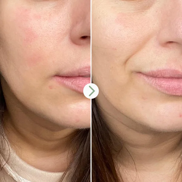 Pai Skincare Partners In Calm Cleanser & Moisturiser Set