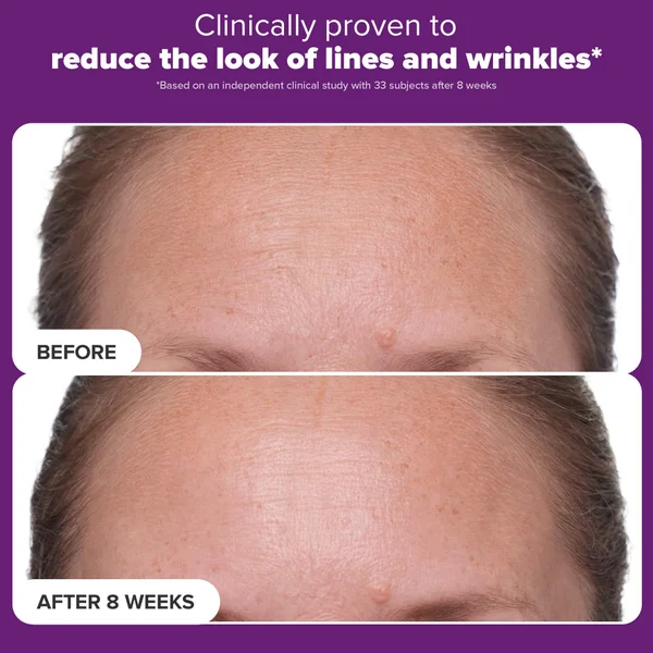 Paula's Choice Clinical 1% Retinol Treatment (30ml)