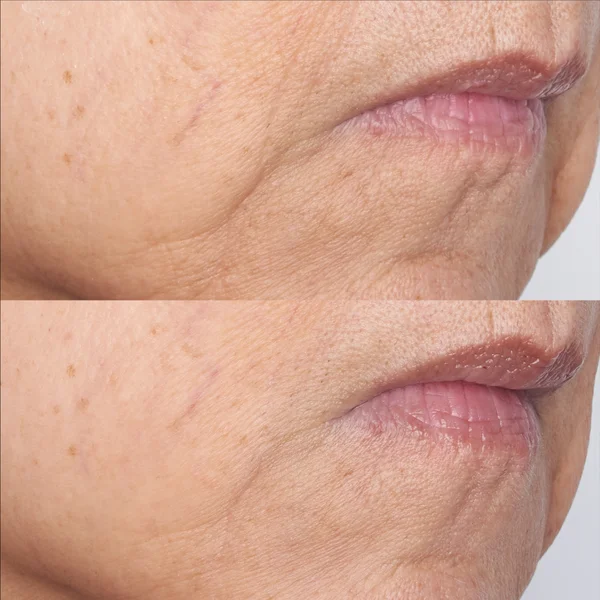 Perricone MD Cold Plasma Plus+ The Intensive Gel Mask