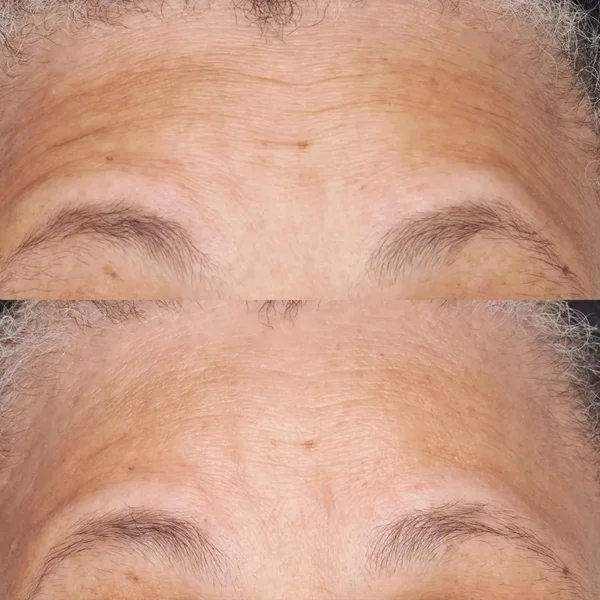 Perricone MD Hypo Clean Correction Barrier Repair Nourishing Moisturizer 2oz FG