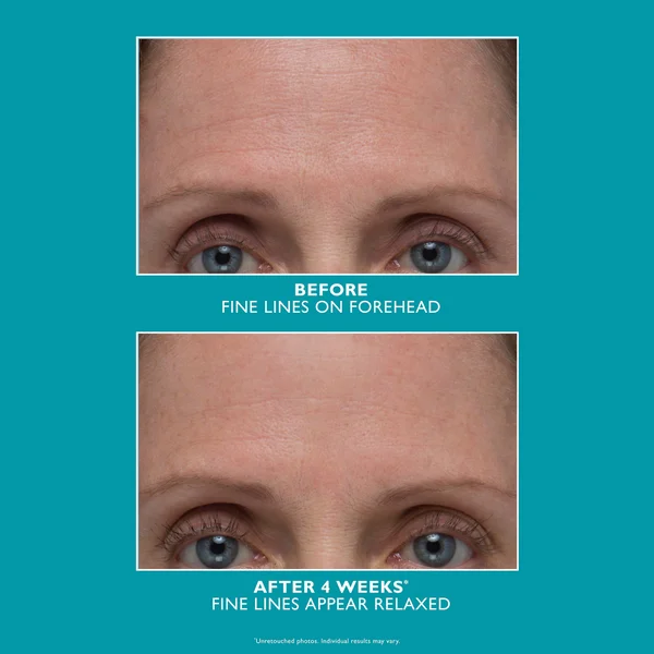 Peter Thomas Roth Peptide Skinjection Amplified Wrinkle-Fix Refillable Serum 30ml