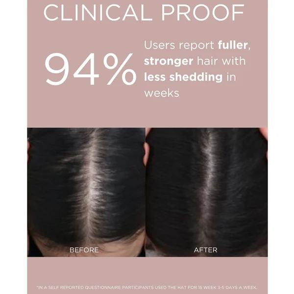 Solaris Labs NY Hair Boost Red LED Hat Supporting Growth