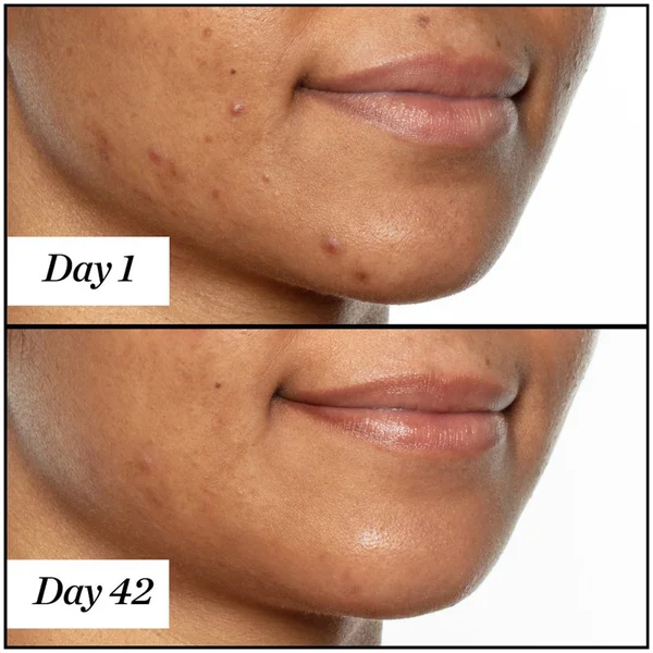 Sunday Riley U.F.O. Ultra-Clarifying Face Oil 15ml