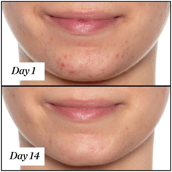 Sunday Riley U.F.O. Ultra-Clarifying Face Oil 15ml