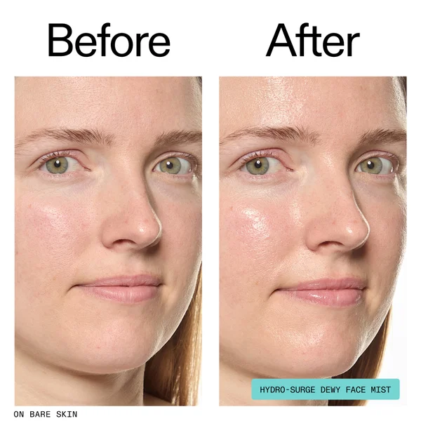 The INKEY List Hydro-Surge Dewy Face Mist 75ml