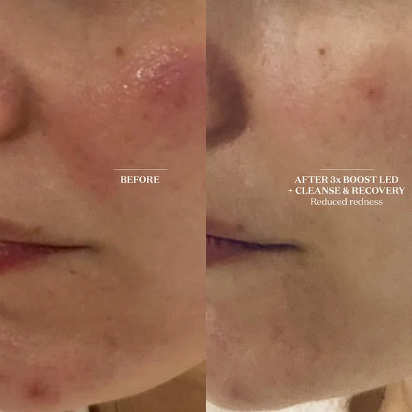 The Light Salon Cleanse And Recovery Spray 100ml