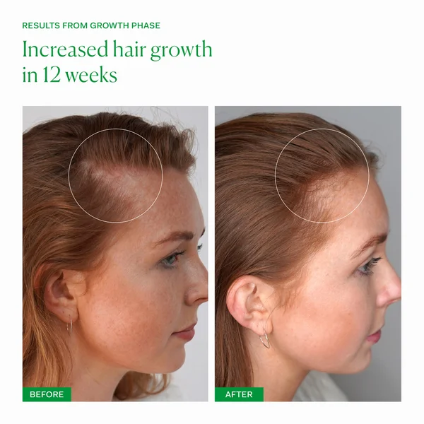 The Nue Co. Growth Phase Hair Supplements (90 Capsules)