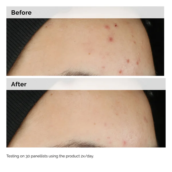 The Ordinary Balancing And Clarifying Serum 30ml