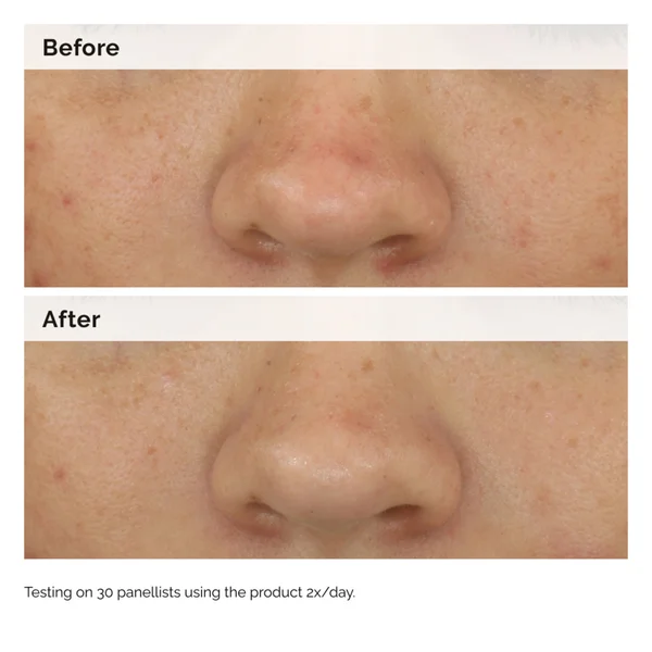 The Ordinary Balancing And Clarifying Serum 30ml