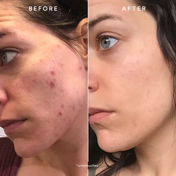 True Botanicals Clear Repair Nightly Treatment 30ml